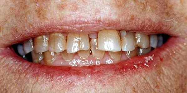 Cosmetic Dental Treatments