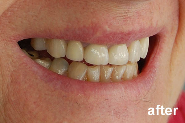 Cosmetic Dental Treatments