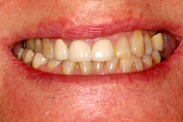 Cosmetic Dental Treatments