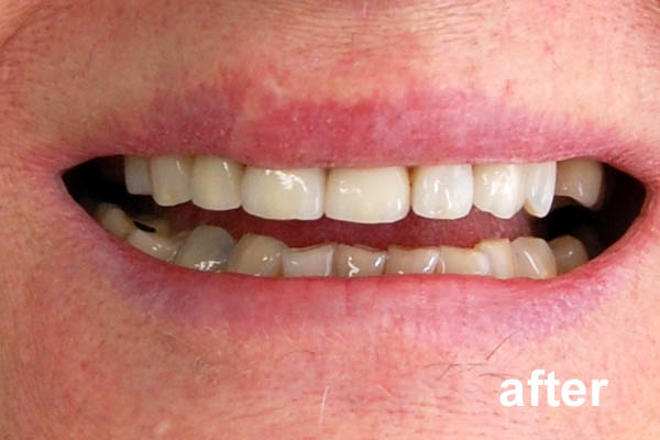 Cosmetic Dental Treatments