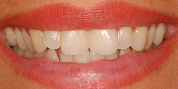 Cosmetic Dental Treatments