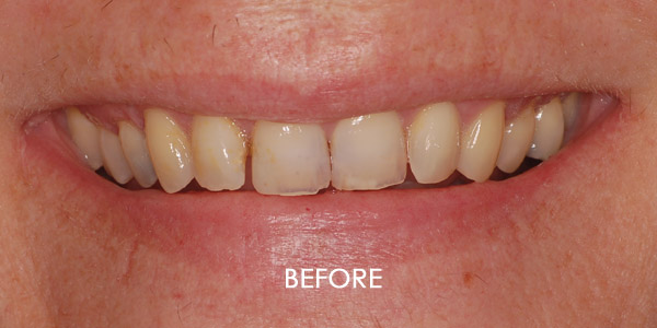 Cosmetic Dental Treatments